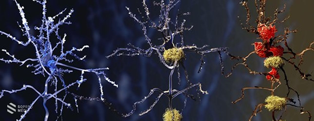 Sok funkciót ellátó fehérje szerkezetét tárták fel az ELKH TTK kutatói

