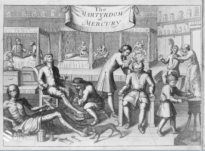 Szifiliszes betegek gyógykezelése egy 17. századi rézmetszeten
