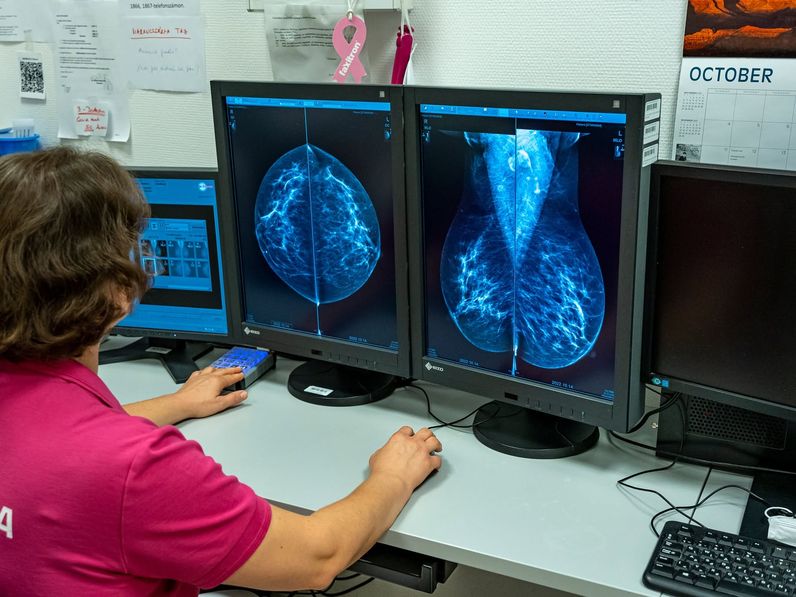 Mammográfiás szűrőnapokat szervez a Soproni Gyógyközpont!